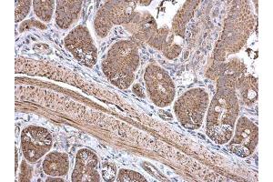Immunohistochemistry (IHC) image for anti-Enoyl CoA Hydratase, Short Chain, 1, Mitochondrial (ECHS1) antibody (ABIN2855654)