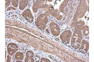 IHC-P Image ECH1 antibody [N1C3] detects ECH1 protein at cytoplasm in mouse intestine by immunohistochemical analysis.