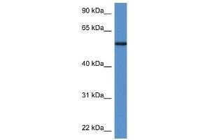 Western Blot showing PGM5 antibody used at a concentration of 1 ug/ml against Fetal Heart Lysate (Phosphoglucomutase 5 抗体  (N-Term))