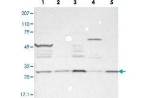 Western blot analysis of Lane 1: RT-4, Lane 2: EFO-21, Lane 3: A-431, Lane 4: Liver, Lane 5: Tonsil with FAM109B polyclonal antibody . (FAM109B 抗体)