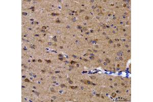 IHC analysis of GRB10 using anti-GRB10 antibody (ABIN7599160). (GRB10 抗体  (AA 1-251))