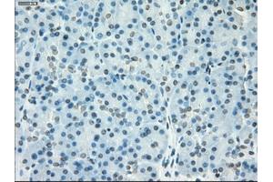 Immunohistochemical staining of paraffin-embedded colon tissue using anti-SSX2mouse monoclonal antibody. (SSX2 抗体)