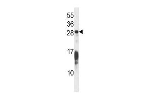 Western Blotting (WB) image for anti-RAP1B, Member of RAS Oncogene Family (RAP1B) (AA 150-178), (C-Term) antibody (ABIN5537994)