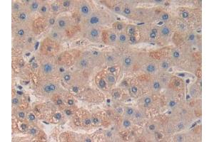 DAB staining on IHC-P; Samples: Human Liver Tissue (MAPKAP Kinase 3 抗体  (AA 129-329))