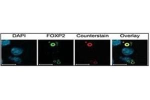 Characterization of FOXP2 isoforms using FOXP2 Ab (green) and Ubiquitin antibody (aggresome marker) (red). (Ubiquitin 抗体  (AA 36-66))