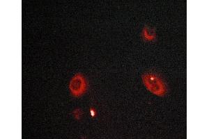 ABIN6268992 staining LOVO cells by ICC/IF. (MMP8 抗体  (C-Term))