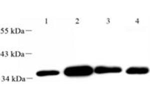 Western blot analysis of FLJ22167 (ABIN7073961) at dilution of 1: 2000,Lane 1: Mouse uterus tissue lysate,Lane 2: Mouse lung tissue lysate,Lane 3: Mouse ovary tissue lysate,Lane 4: Rat ovary tissue lysate (FLJ22167 抗体)