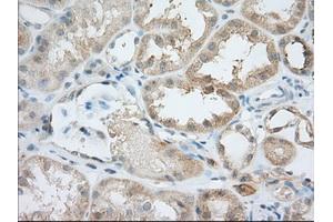 Immunohistochemical staining of paraffin-embedded Human Kidney tissue using anti-BIRC5 mouse monoclonal antibody. (Survivin 抗体)