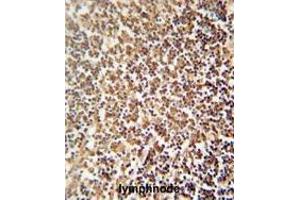 ZNF98 antibody (C-term) immunohistochemistry analysis in formalin fixed and paraffin embedded human lymphnode followed by peroxidase conjugation of the secondary antibody and DAB staining. (ZNF98 抗体  (C-Term))