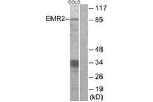 Western blot analysis of extracts from COLO cells, using EMR2 Antibody. (EMR2 抗体  (AA 765-814))