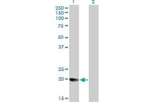 Western Blot analysis of DHRS11 expression in transfected 293T cell line by DHRS11 MaxPab polyclonal antibody. (DHRS11 抗体  (AA 1-181))