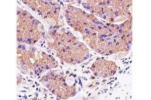Immunohistochemical analysis of paraffin-embedded human stomach using Pink1 antibody at 1:25 dilution. (PINK1 抗体)