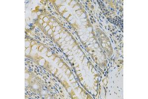 Immunohistochemistry of paraffin-embedded rat intestine using CAMK1D Antibody (ABIN5975586) at dilution of 1/100 (40x lens). (CAMK1D 抗体)