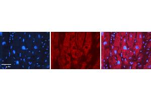 Rabbit Anti-EFEMP1 Antibody   Formalin Fixed Paraffin Embedded Tissue: Human heart Tissue Observed Staining: Cytoplasmic Primary Antibody Concentration: 1:100 Other Working Concentrations: 1:600 Secondary Antibody: Donkey anti-Rabbit-Cy3 Secondary Antibody Concentration: 1:200 Magnification: 20X Exposure Time: 0. (FBLN3 抗体  (Middle Region))