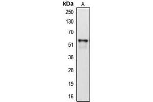 Western blot analysis of Cytochrome P450 2A6 expression in HepG2 (A) whole cell lysates. (CYP2A6 抗体  (Center))