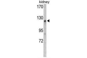 Western blot analysis of WTX antibody (Center) in mouse kidney tissue lysates (35ug/lane). (WTX 抗体  (Middle Region))