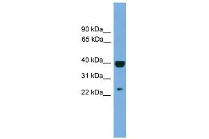 WB Suggested Anti-SOCS1 Antibody Titration:  0. (SOCS1 抗体  (Middle Region))