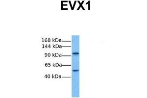 Host:  Rabbit  Target Name:  EVX1  Sample Tissue:  Human Fetal Lung  Antibody Dilution:  1. (EVX1 抗体  (N-Term))