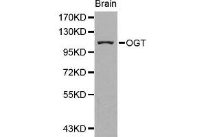 Western blot analysis of extracts of human brain cell line, using OGT antibody. (OGT 抗体)