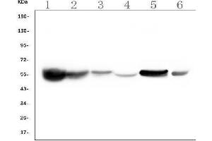 Western blot analysis of ALDH2 using anti-ALDH2 antibody (ABIN7603122). (ALDH2 抗体  (N-Term))