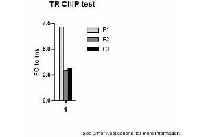 Image no. 2 for anti-Thyroid Hormone Receptor, beta (THRB) (N-Term) antibody (ABIN2779904) (THRB 抗体  (N-Term))