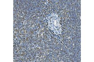 IHC analysis of GILT/IFI30 using anti-GILT/IFI30 antibody (ABIN7601299).