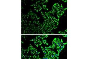Immunofluorescence analysis of HeLa cells using Hsp60 Polyclonal Antibody (HSPD1 抗体)