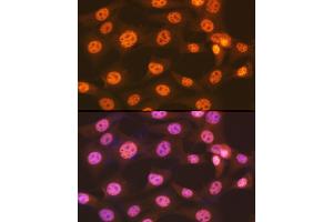 Immunofluorescence (IF) image for anti-Solute Carrier Family 29 (Nucleoside Transporters), Member 2 (SLC29A2) antibody (ABIN7270448)