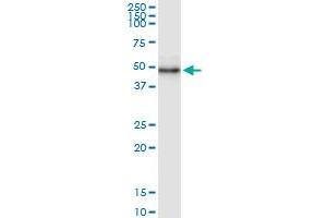 Immunoprecipitation of WDR19 transfected lysate using anti-WDR19 MaxPab rabbit polyclonal antibody and Protein A Magnetic Bead , and immunoblotted with WDR19 MaxPab mouse polyclonal antibody (B01) . (WDR19 抗体  (AA 1-437))