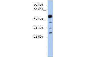 WB Suggested Anti-PGDS Antibody Titration:  0. (PTGDS 抗体  (N-Term))