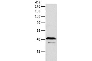 Western Blot analysis of Mouse brain tissue using ADAP1 Polyclonal Antibody at dilution of 1:500 (ADAP1 抗体)