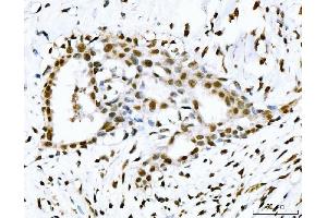 IHC analysis of 53BP1/TP53BP1 using anti-53BP1/TP53BP1 antibody (ABIN7599869).