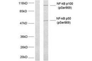 Western blot analysis of extracts from MDA-MB-435 cells treated with TNF-alpha, using NF-kappaB p100/p52 (Phospho-Ser869) Antibody. (NFKB2 抗体  (pSer870))