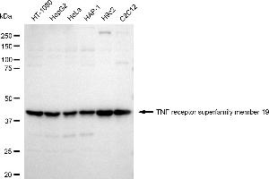 Western blotting analysis using TNF receptor superfamily member 19 antibody (ABIN7800675).