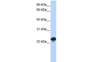 WB Suggested Anti-CAPS Antibody Titration: 0. (Calcyphosine 抗体  (N-Term))