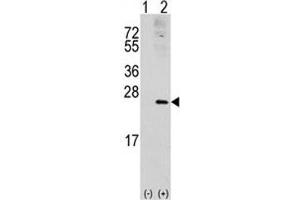 Western blot analysis of RAC1 antibody and 293 cell lysate (2 ug/lane) either nontransfected (Lane 1) or transiently transfected with the RAC1 gene (2). (RAC1 抗体  (AA 49-78))