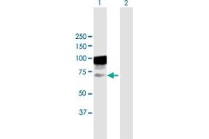 Western Blot analysis of TIAM2 expression in transfected 293T cell line by TIAM2 MaxPab polyclonal antibody. (TIAM2 抗体  (AA 1-626))