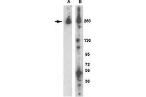 Western blot analysis of LRRK2 antibody: (A) 293 cells transiently transfected with the PARK8/LRRK2 gene; (B) mouse brain.