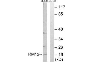 Western Blotting (WB) image for anti-Mitochondrial Ribosomal Protein L12 (MRPL12) (Internal Region) antibody (ABIN1850542) (MRPL12 抗体  (Internal Region))