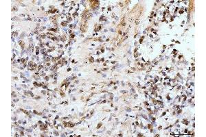 IHC analysis of IFI16 using anti-IFI16 antibody (ABIN7600374). (IFI16 抗体  (AA 183-743))