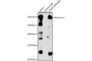 Immunoprecipitation analysis of 200 μg extracts of Jurkat cells, using 3 μg Filamin A antibody (ABIN6127907, ABIN6140677, ABIN6140679 and ABIN6214030). (Filamin A 抗体  (AA 2348-2647))