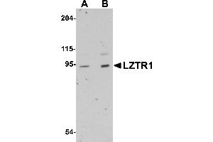 Western Blotting (WB) image for anti-Leucine-Zipper-Like Transcription Regulator 1 (LZTR1) (N-Term) antibody (ABIN1031446) (LZTR1 抗体  (N-Term))
