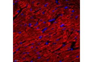 Immunofluorescence (Paraffin-embedded Sections) (IF (p)) image for anti-ATP Synthase, H+ Transporting, Mitochondrial F0 Complex, Subunit C1 (Subunit 9) (ATP5G1) antibody (ABIN7073141)