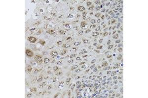 Immunohistochemistry of paraffin-embedded human esophagus using PRKAB1 antibody at dilution of 1:100 (x40 lens).