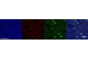 Immunohistochemistry (IHC) image for anti-Aldehyde Dehydrogenase 1 Family, Member A1 (ALDH1A1) antibody (ABIN7456135)