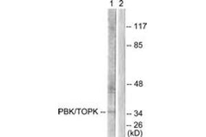 Western blot analysis of extracts from COS7 cells, treated with Nocodazole 1ug/ml 16h, using PBK/TOPK (Ab-9) Antibody.