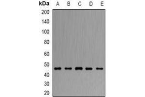Western blot analysis of ARFGAP1 expression in Hela (A), HepG2 (B), mouse liver (C), mouse brain (D), rat lung (E) whole cell lysates. (ARFGAP1 抗体)