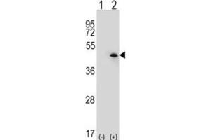 Western Blotting (WB) image for anti-USP12,USP46 antibody (ABIN3001474) (USP12,USP46 抗体)
