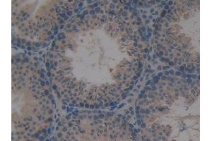 DAB staining on IHC-P; Samples: Mouse Testis Tissue (PKC mu 抗体  (AA 349-612))