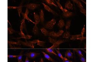 Immunofluorescence analysis of C6 cells using WNT10B Polyclonal Antibody at dilution of 1:100. (WNT10B 抗体)